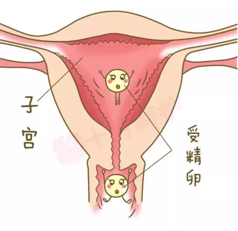 北京代生移植，助孕选性别包成功