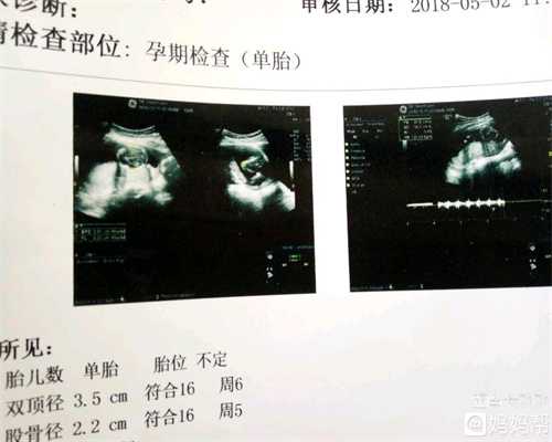 科学胎教才能有利于胎儿成长：济南鑫宝助孕国际信息