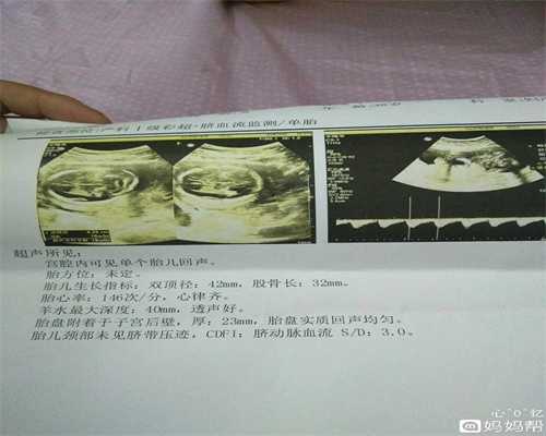 妊娠合并巨大子宫肌瘤术后继续妊娠一例