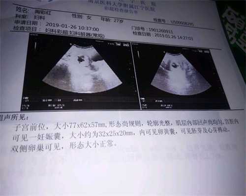 郑州德州鑫宝助孕国际是合法的吗？：女人助孕后的令人