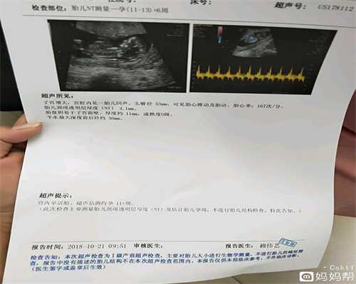 阴道流血是宫外孕的早期症状吗文在寅上任日本