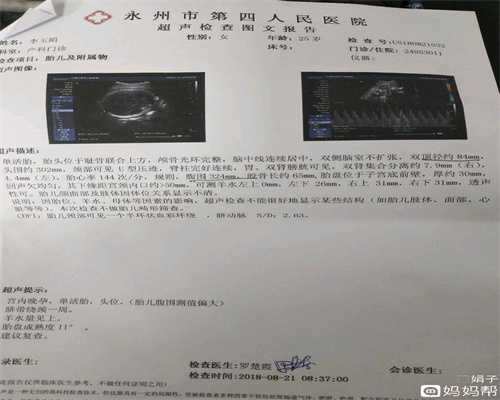 上海高鹰鑫宝助孕国际妈妈：助孕时，男性应戒烟戒酒多