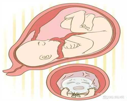 <b>合肥代孕价格明细：做输卵管造影检查会影响代</b>