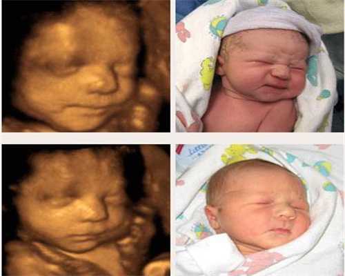 合肥代孕包成功套餐：美国新生儿出生必做检查