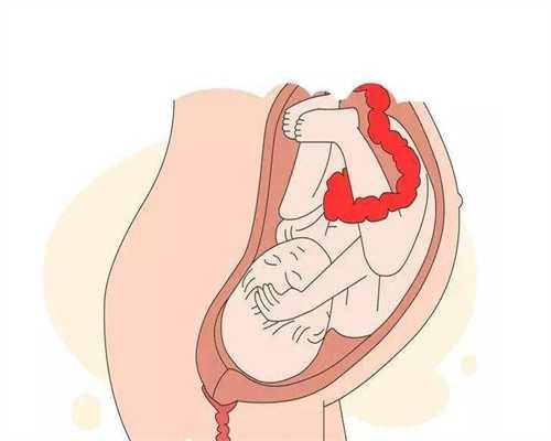鑫宝助孕要多长时间：做试管婴儿条件是啥，哪