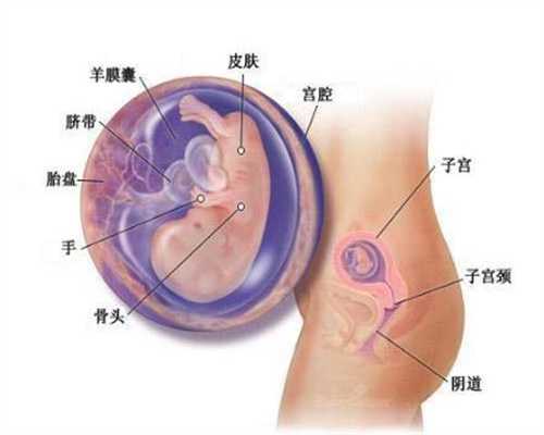 为什么会长子宫内膜息肉手术后还会复发吗