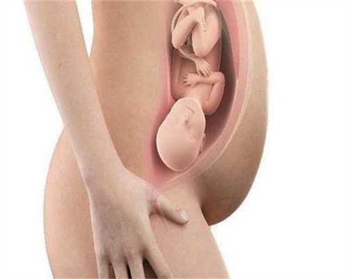 吉林 职业代孕：南昌华山什么情况需要促排卵？