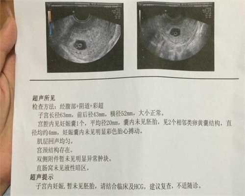 上海代生孩子价格,二胎剖腹产后，要不要结扎避