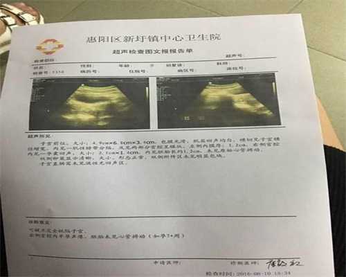 广州代孕产子,做阴超碰到男医生，是什么样的场