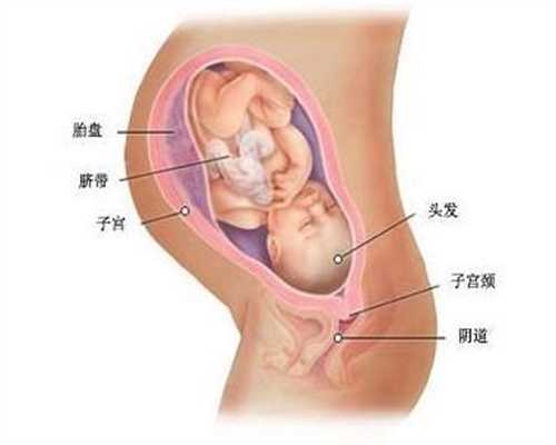 广州代孕机构,输卵管通而不畅怎样治疗才有效