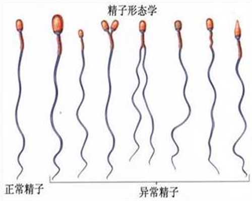 合法代孕服务好的商家,中国代孕最好的机构无痛