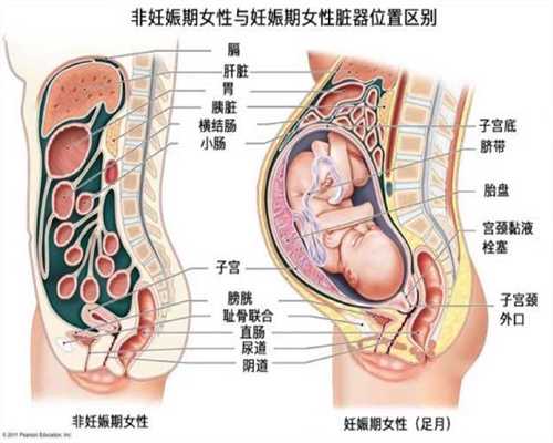 哈尔滨哪地方代孕权威~哈尔滨医疗旅游试管婴儿