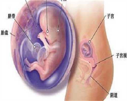 借卵生子的过程_紫朵朵供卵试管婴儿医院胎头入