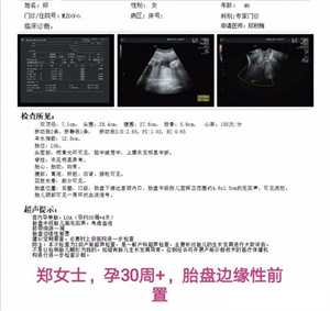 上海第三代试管婴儿机构，中山三院试管前检查报告有效期限制多长时间？